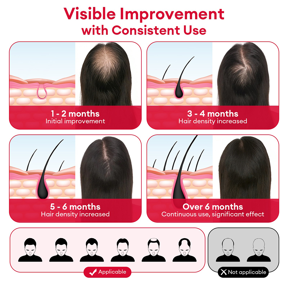 650nm+850nm Red Light Infrared - Hair Care Vegan ulasan dan harga