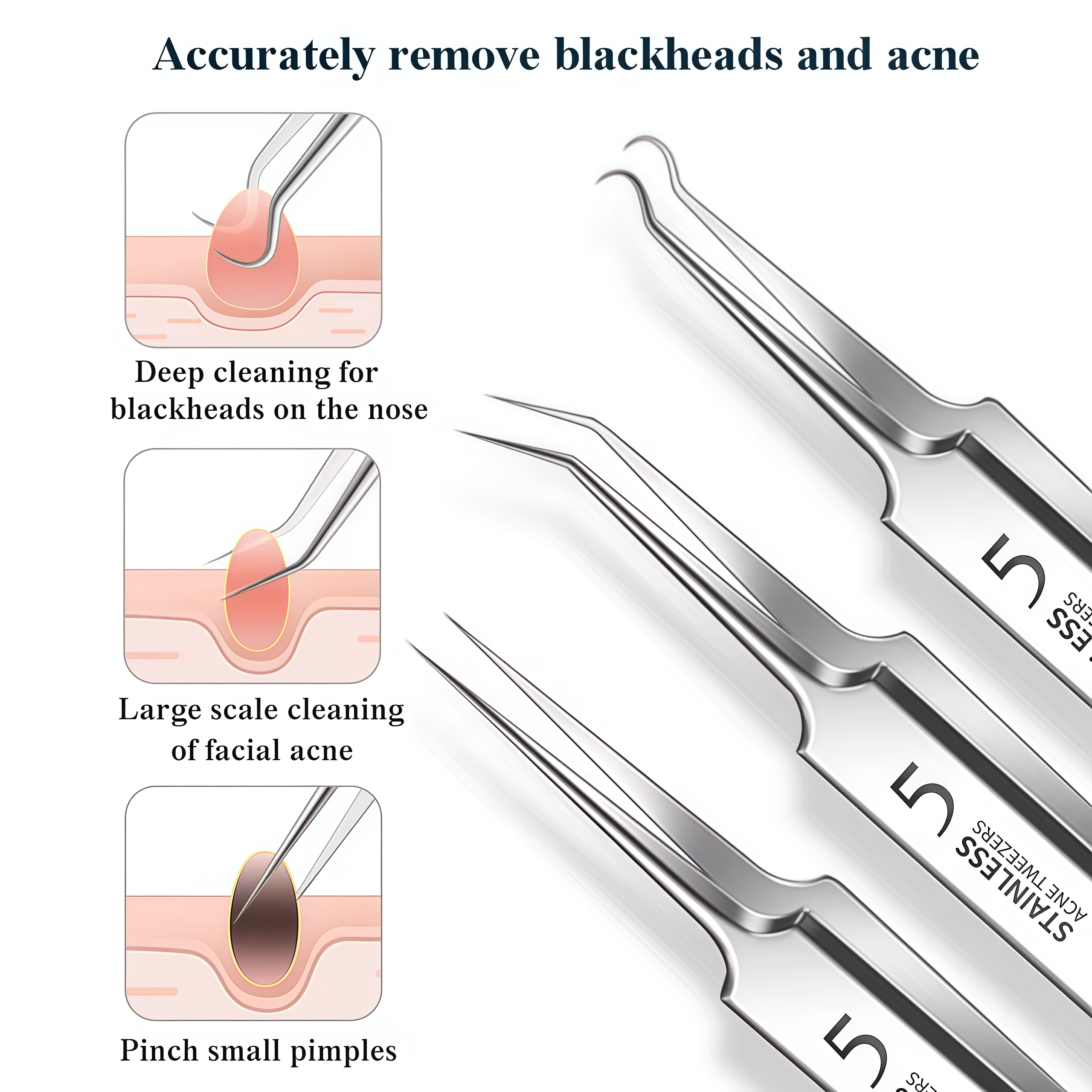 4-11Pcs Ingrown Hair Tweezers  - Hair Care Tools ulasan dan harga