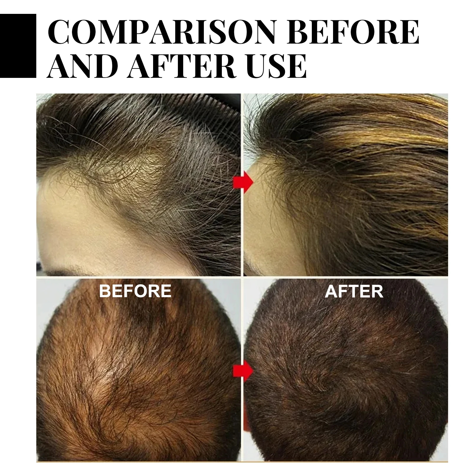 Ginger Hair Growth spray Anti  - Hair Care Vegan ulasan dan harga