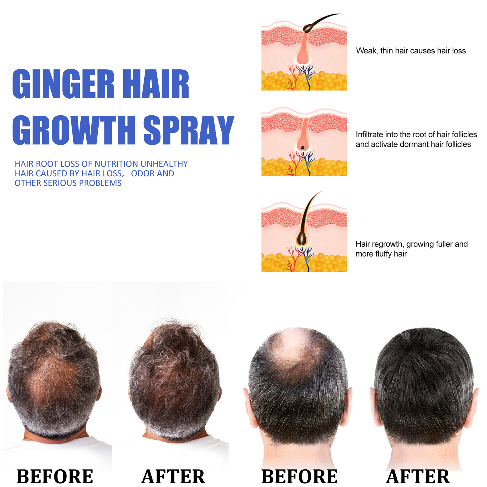 Ginger Hair Growth spray Anti  - Hair Care Vegan ulasan dan harga